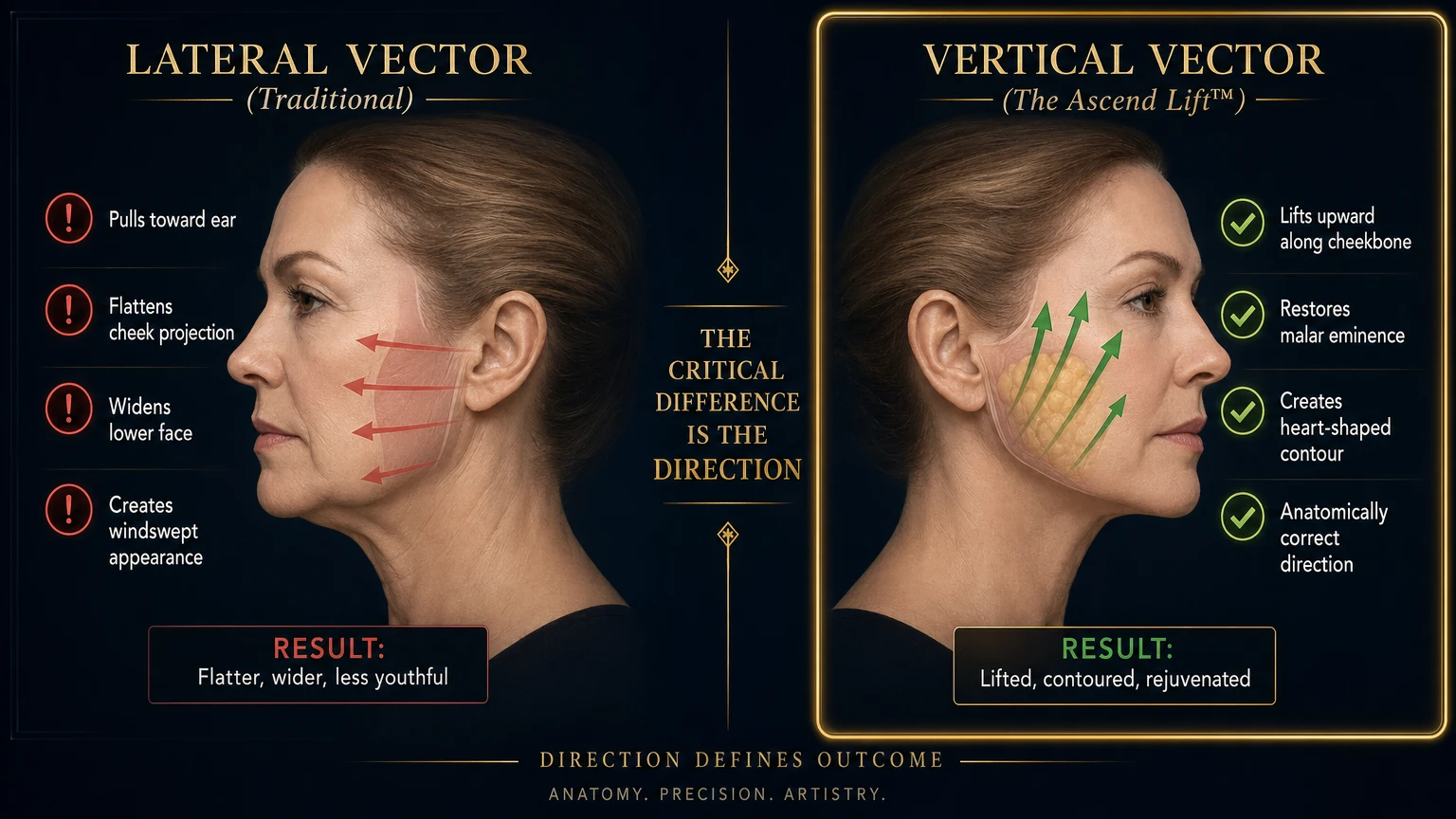 Facelift vector comparison: Lateral vector (traditional) causes windswept appearance vs. Vertical vector (The Ascend Lift) restores natural heart-shaped facial contour — Dr. Shim Ching, Honolulu